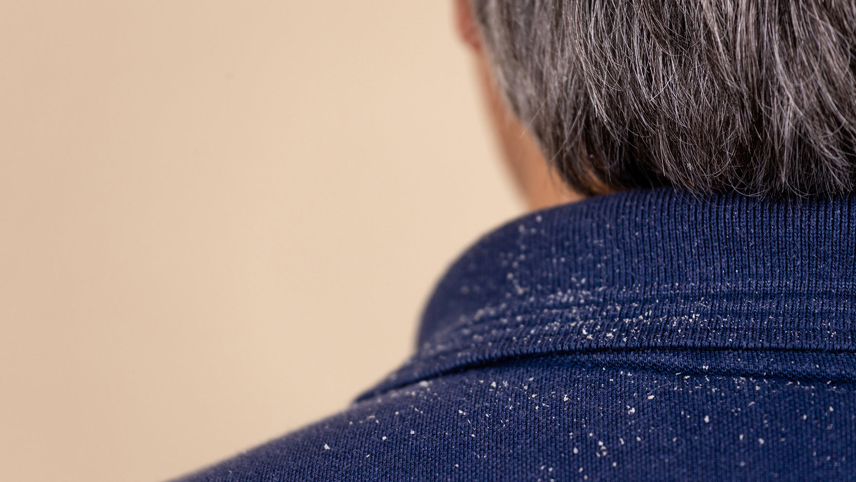 Weg met hoofdhuid schilfers: 6 stappen voor een frisse en gezonde hoofdhuid